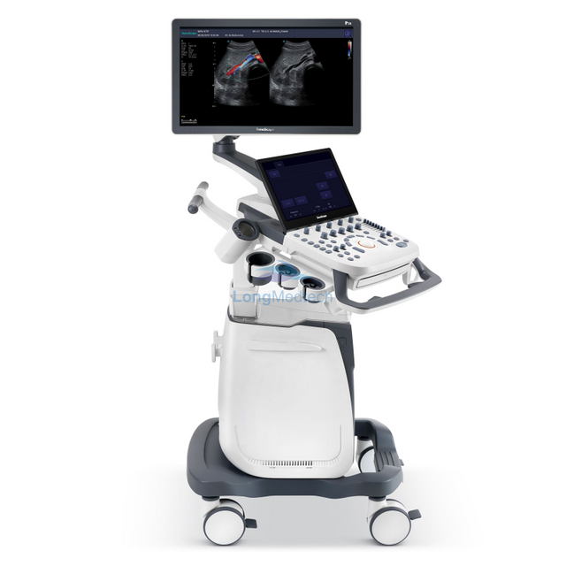 Sonoscape P25 Trolley Color Doppler