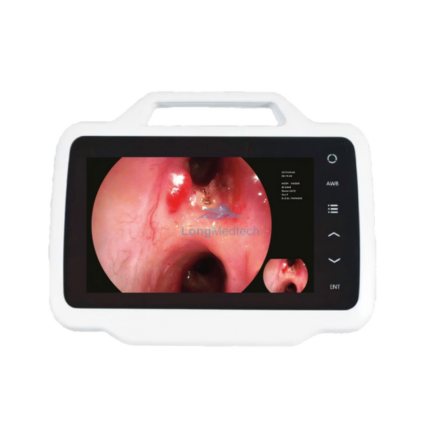 200 Series Endoscopy System