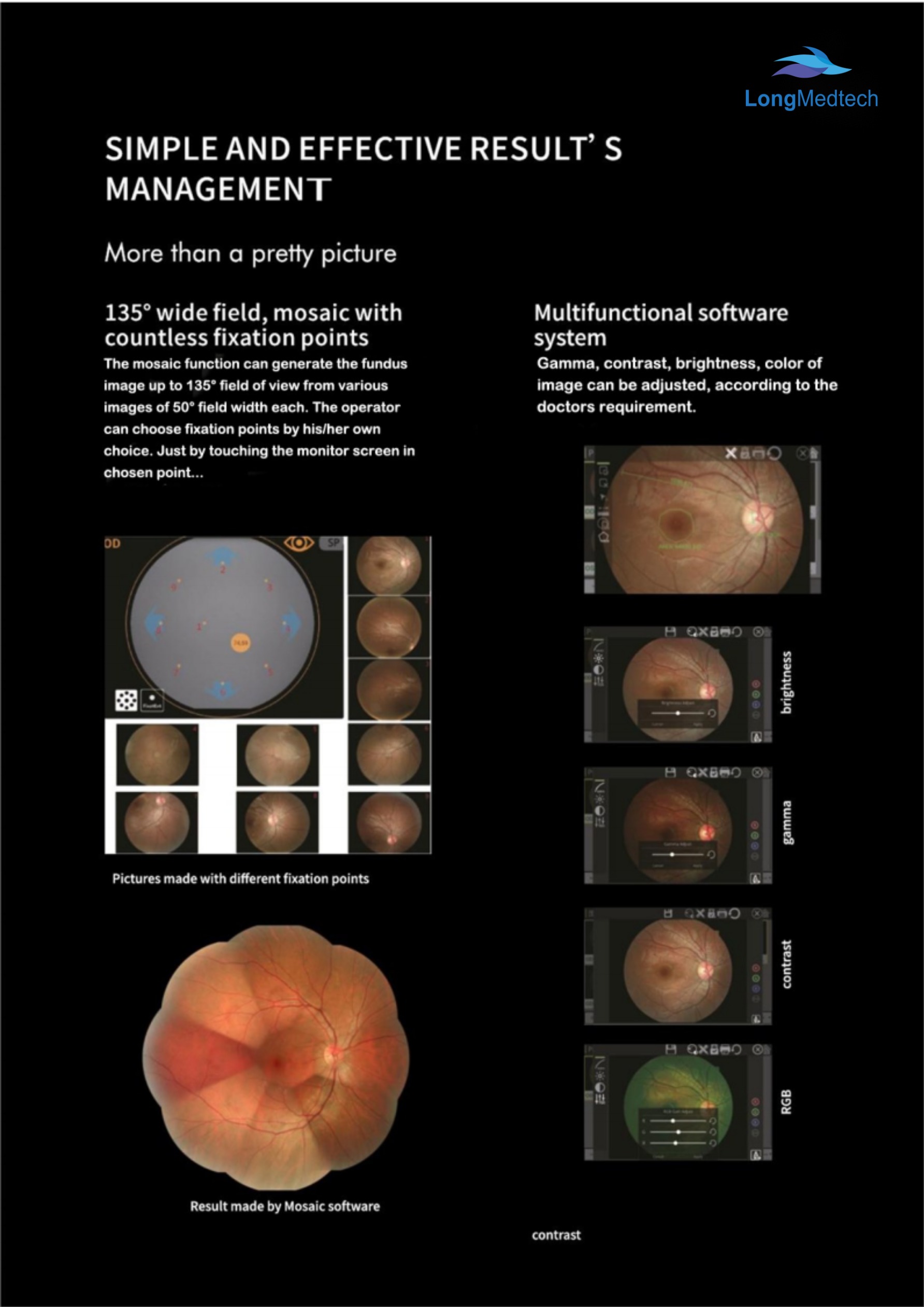 LOY-3100 SYSEYE Imagen del fondo de ojo-7