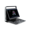 Sonoscape E2 Portable Color Doppler