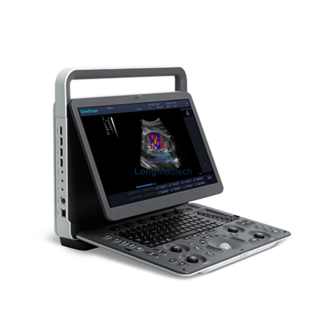 Sonoscape E2 Portable Color Doppler