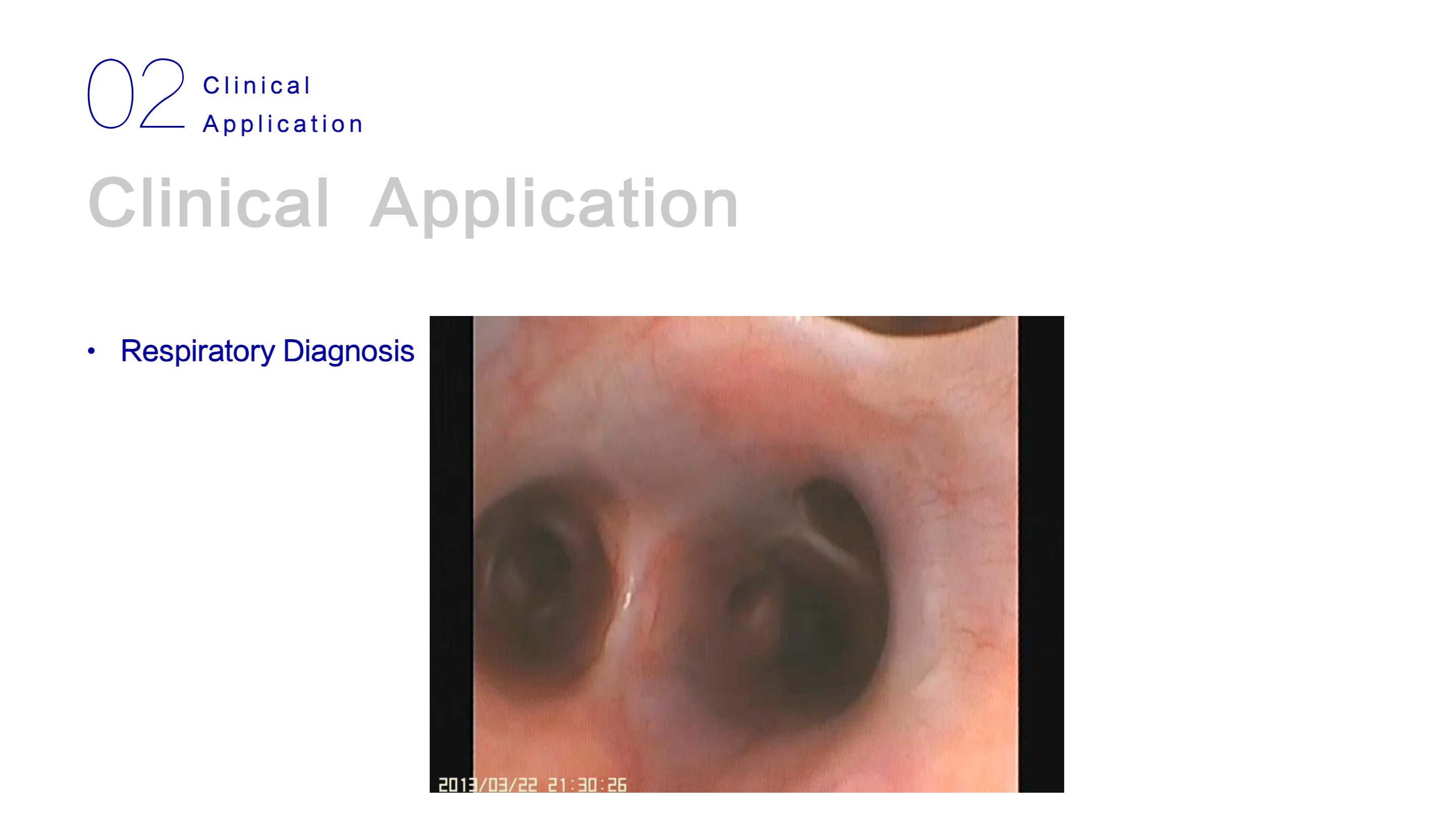 LHO-10 Mobile Endoscopy System-17