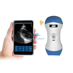 3in1 Palm Doppler Ultrasound
