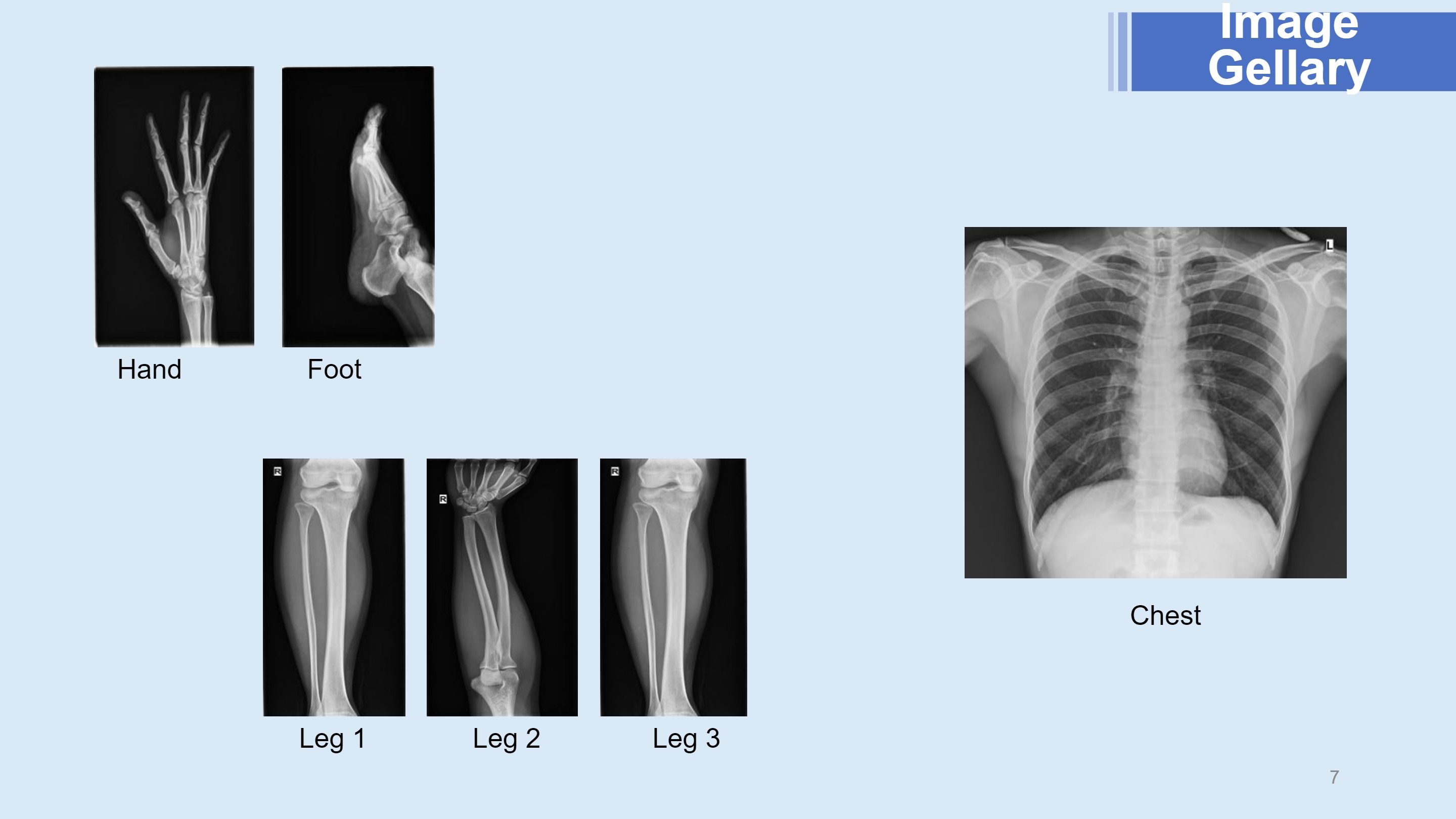 LXR-88 Wire Flat Panel Detector-7