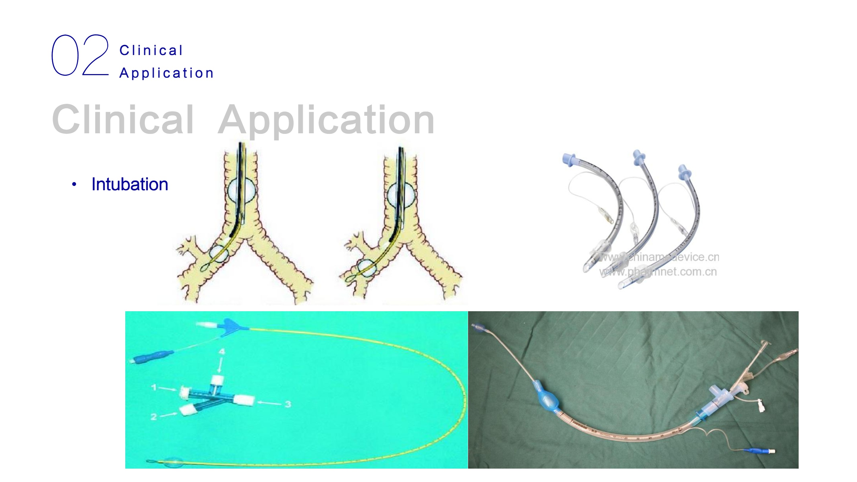 LHO-10 Mobile Endoscopy System-18