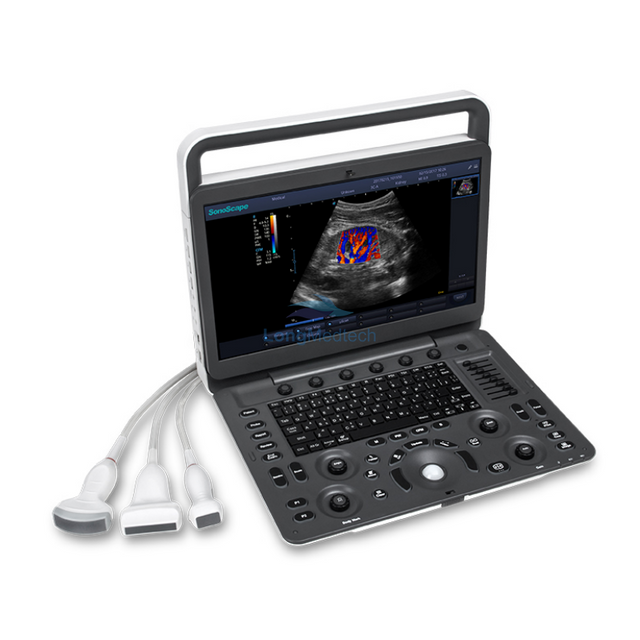Sonoscape E3 Portable Color Doppler