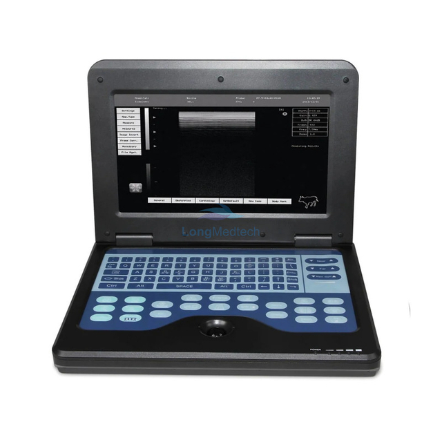 CMS600P2 Portable B Ultrasound Machine