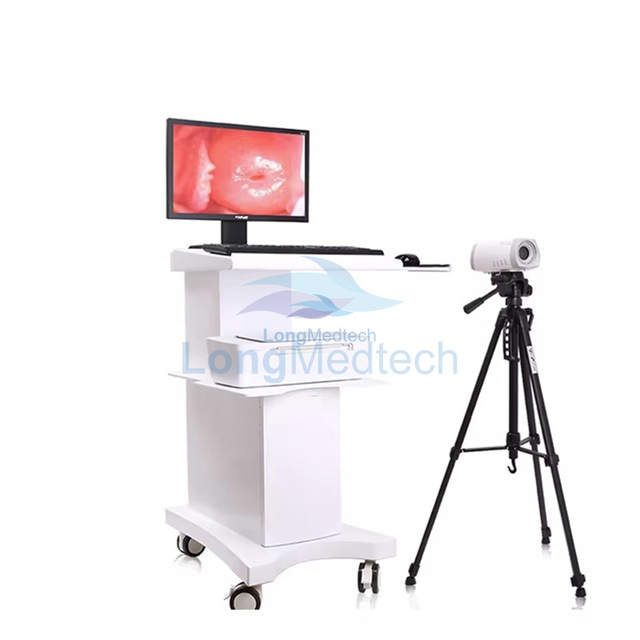 LKX9 Mobile Digital Video Colposcope
