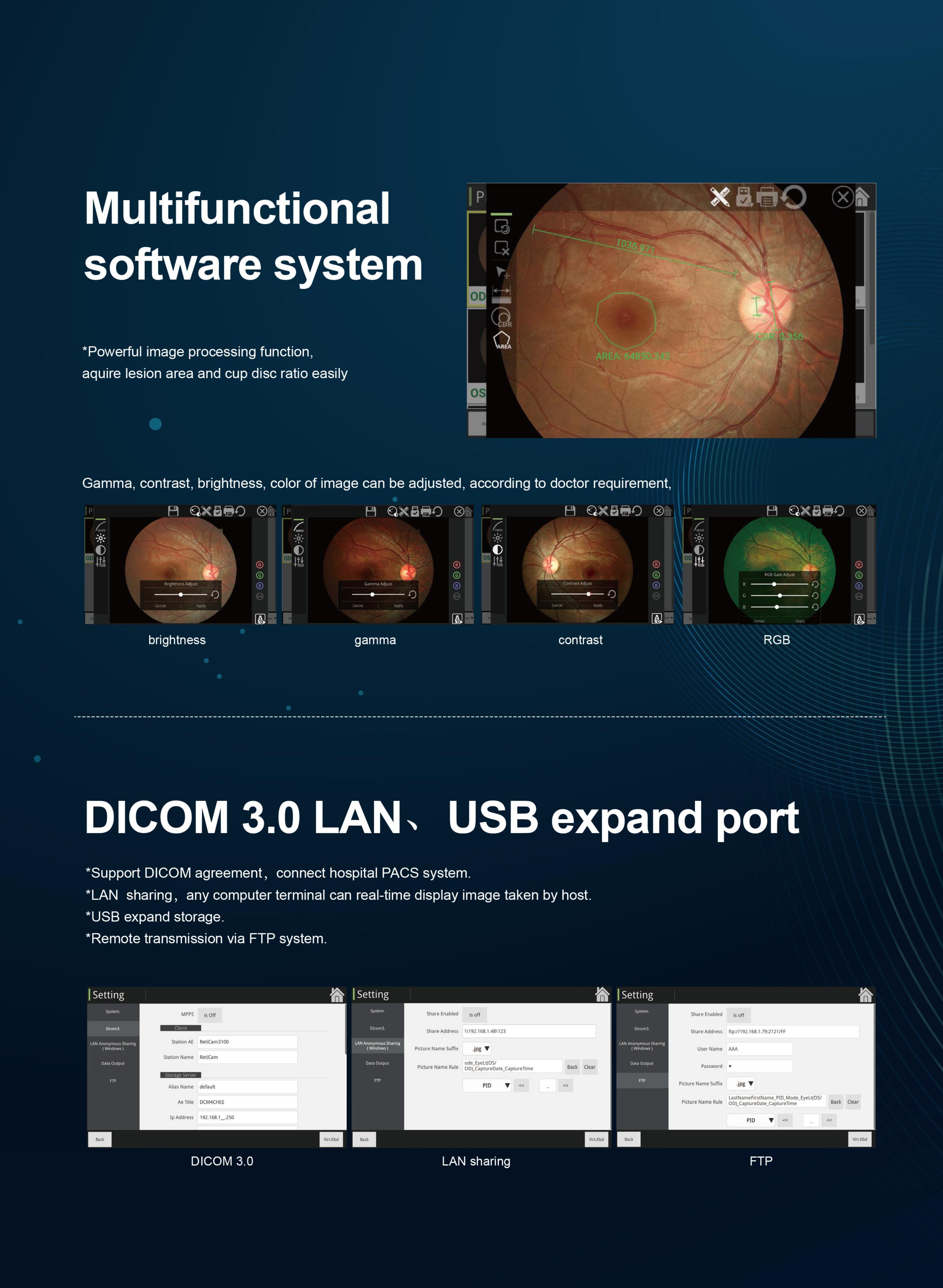 Cam&eacute;ra de fond automatique non mydriatique LM-3100-6