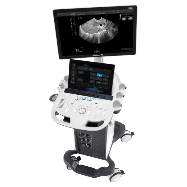 Sonoscape P9 Elite Trolley Color Doppler