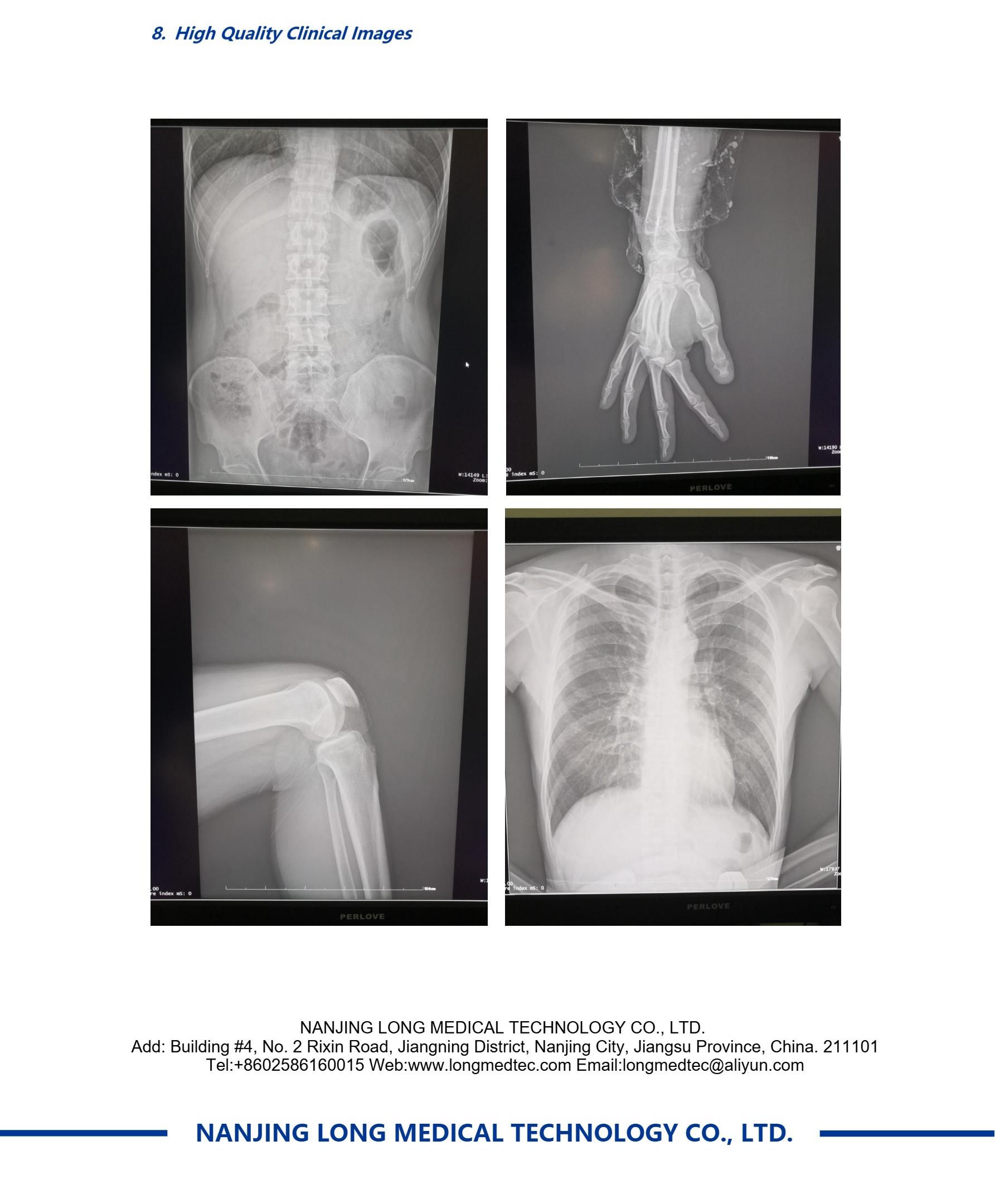 LXR2500 Digital Mobile X-Ray Machine-5