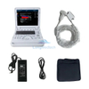 CMS1700A Factory Portable Ultrasound Machine