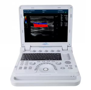 Portable Ultrasound Equipment/Color Doppler Ultrasonic Diagnostic Device