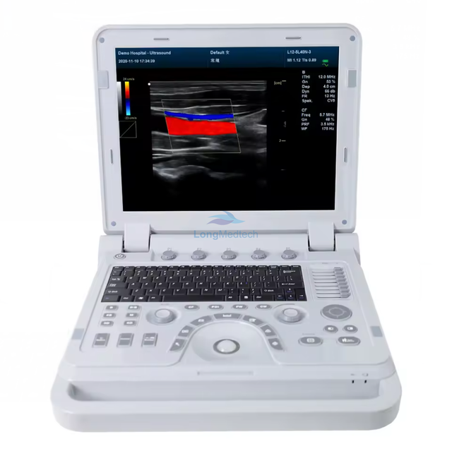 Portable Ultrasound Equipment/Color Doppler Ultrasonic Diagnostic Device