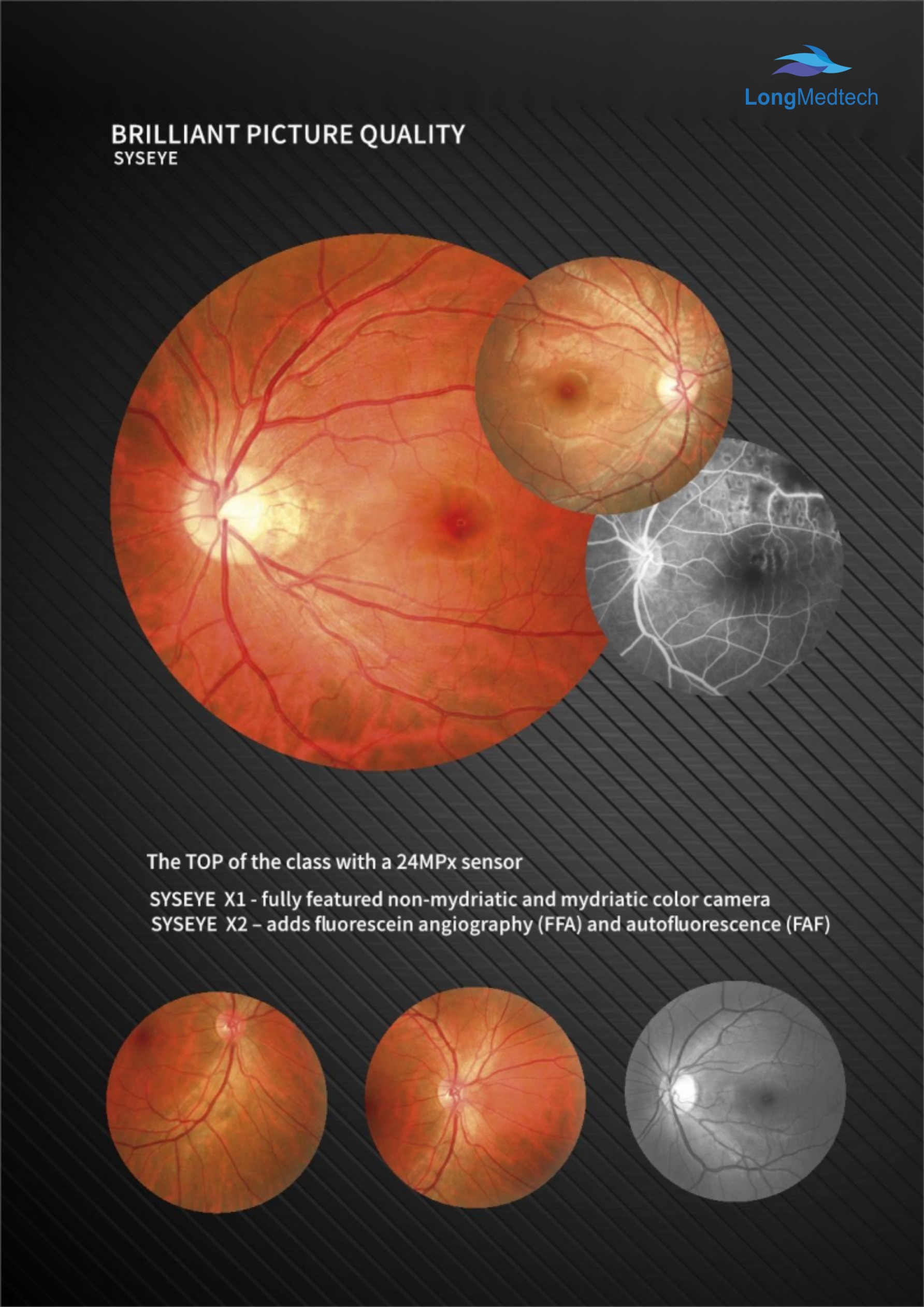 LOY-3100 SYSEYE Imagen del fondo de ojo-3