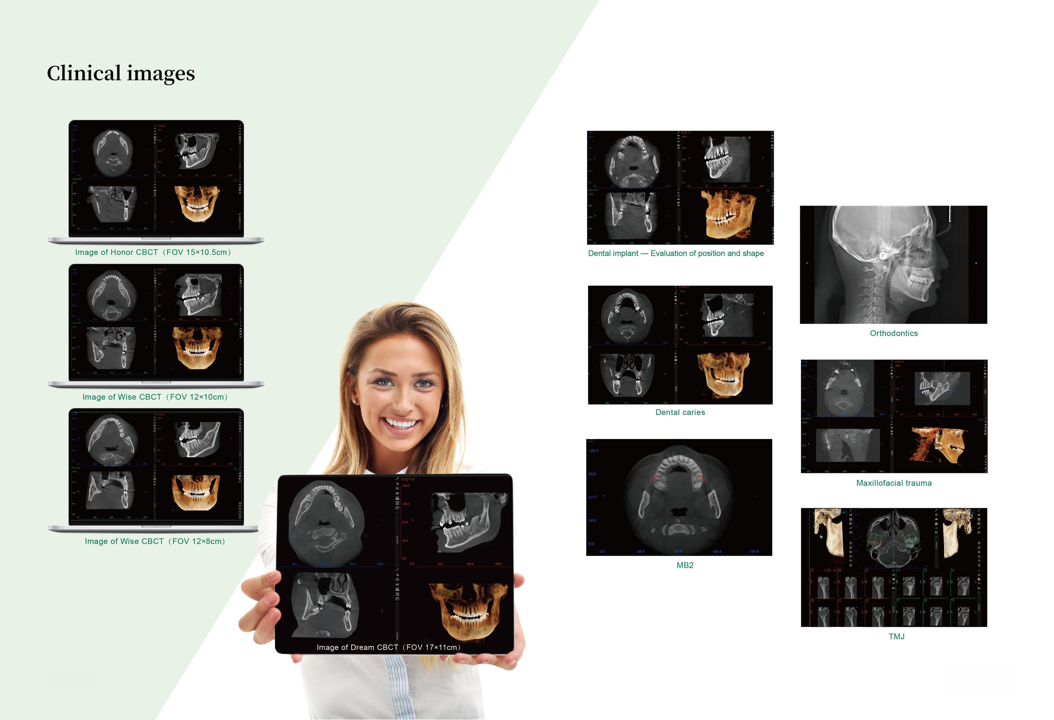 LMD-X600-3D LMD-X600-3DE CBCT 3D PRC-5