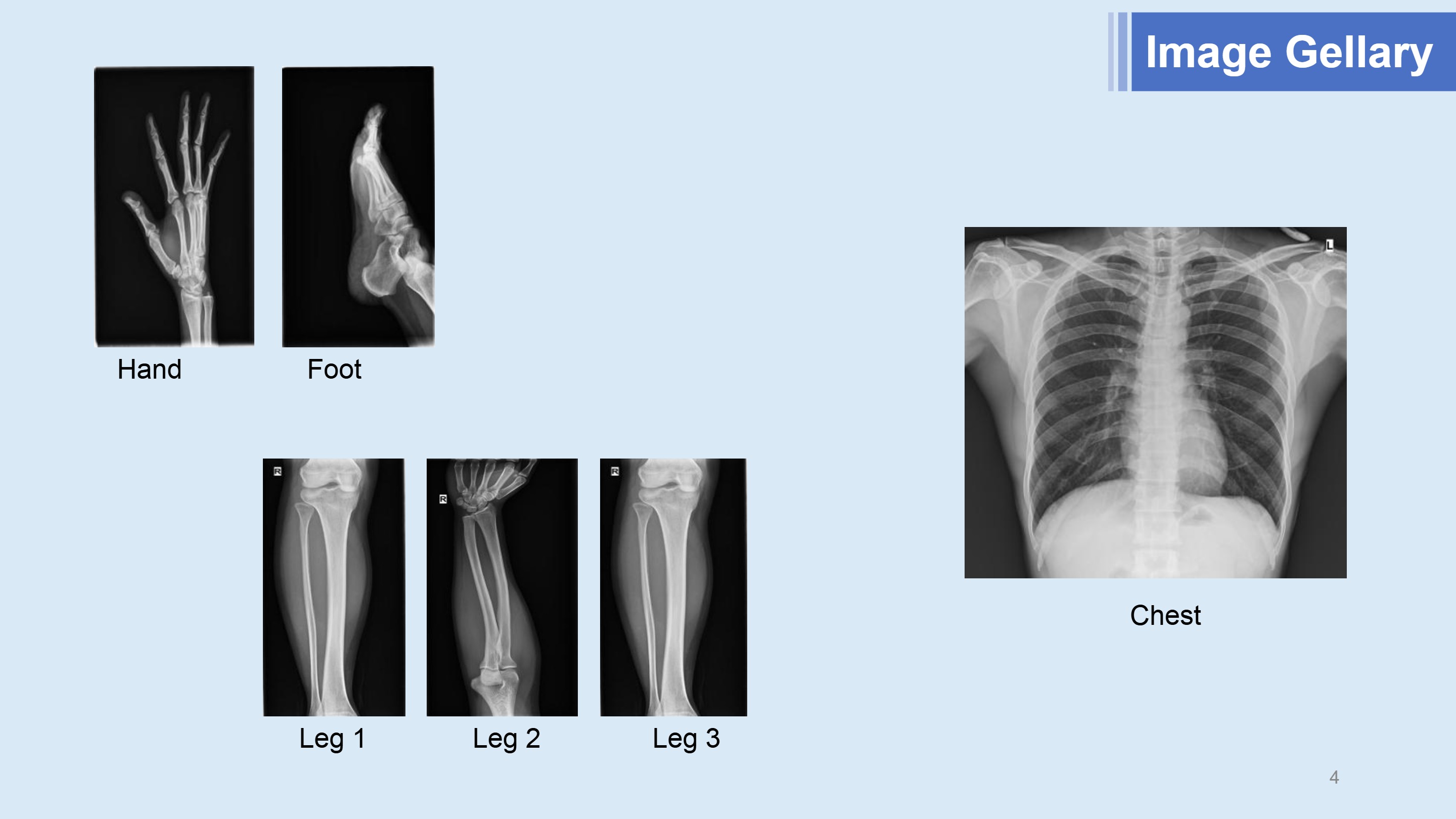 Appareil &agrave; rayons X portable LXR-800 (analogique)-4