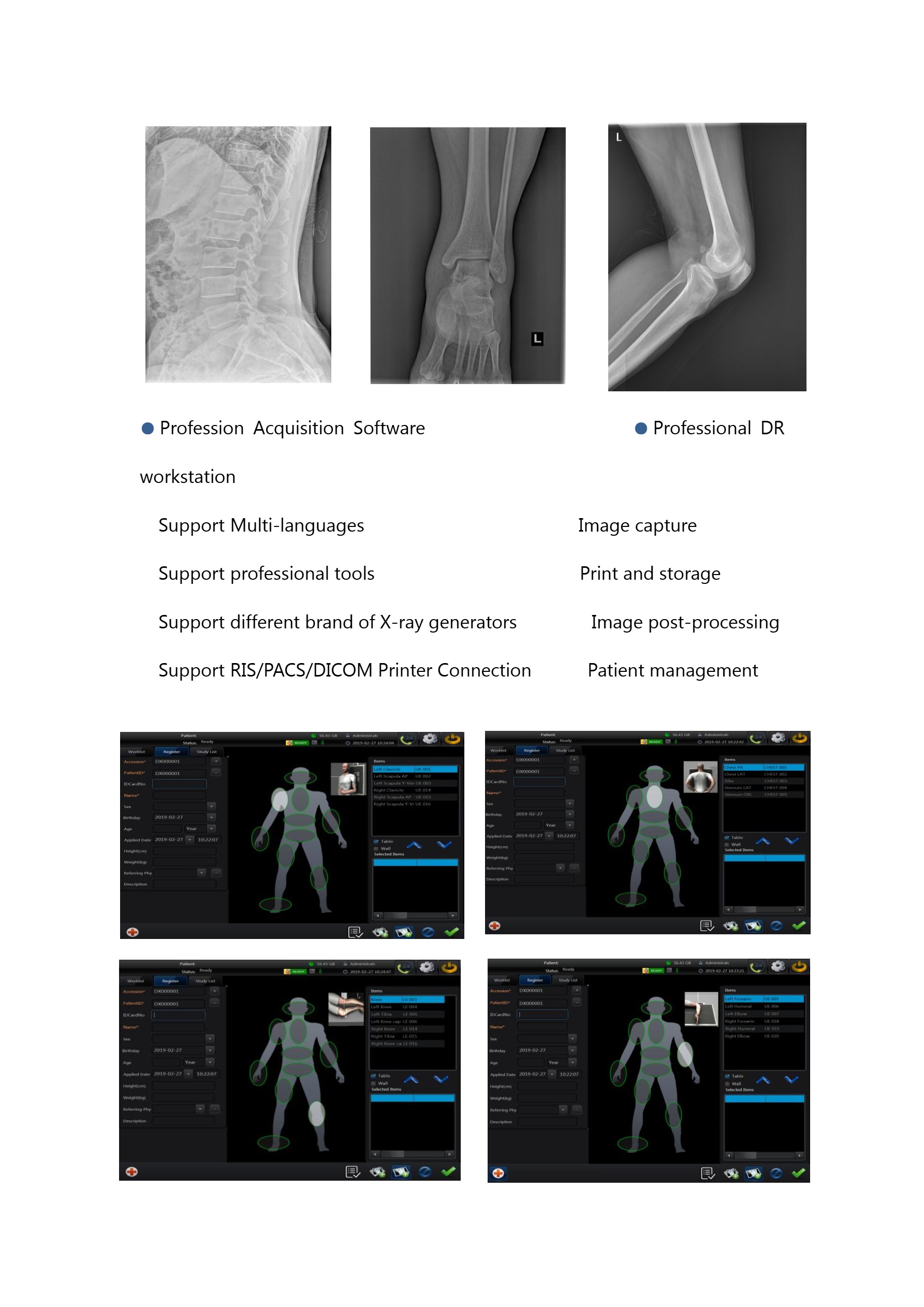 LXR200 Analogue High Fequency X-ray Machine-5