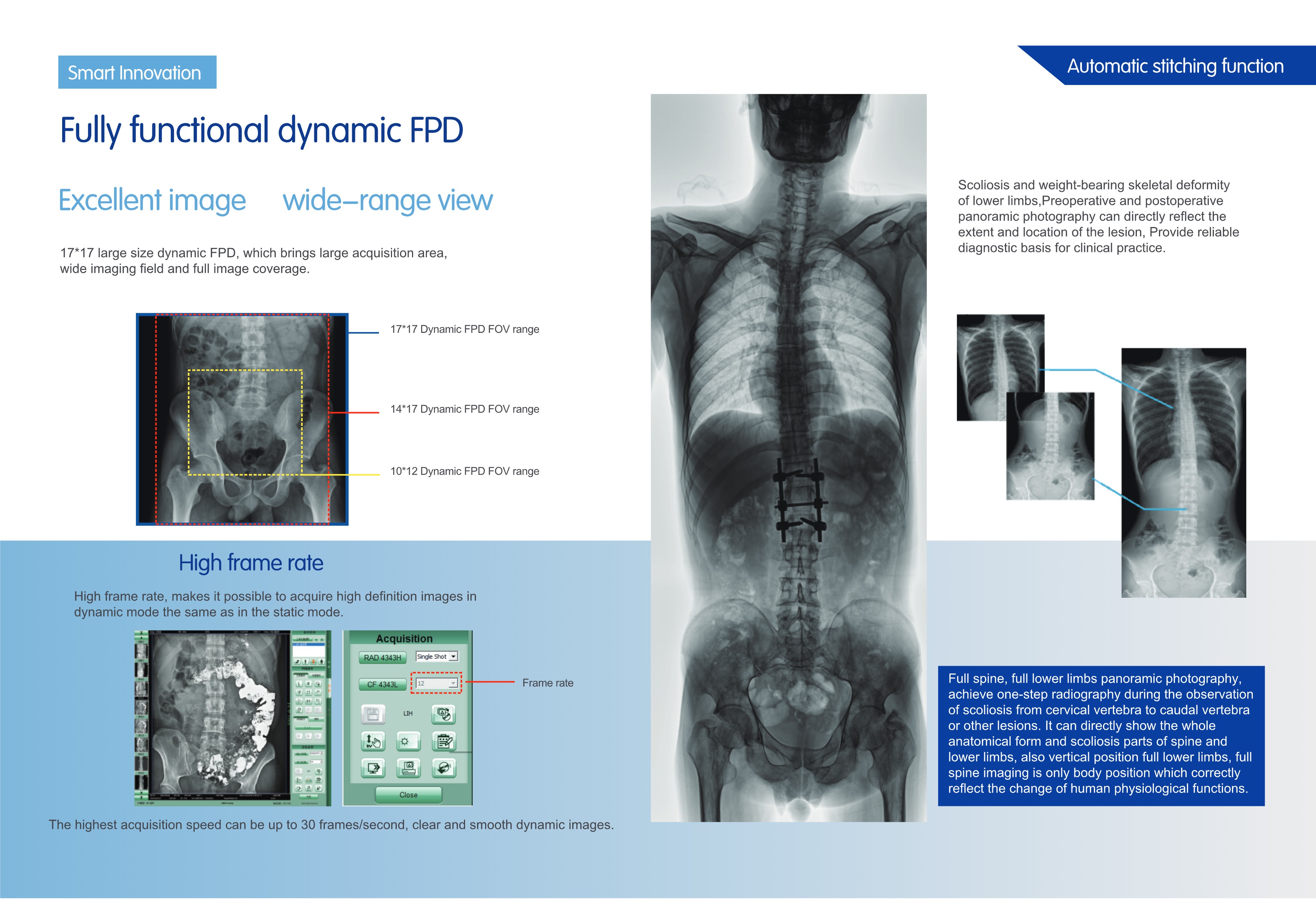 PLD9600A Dynamic FPD RF System HF Digital Radiograghy and Fluoroscopy System-4