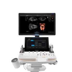 SonoScape P60 Exp Intelligent Future Attainable