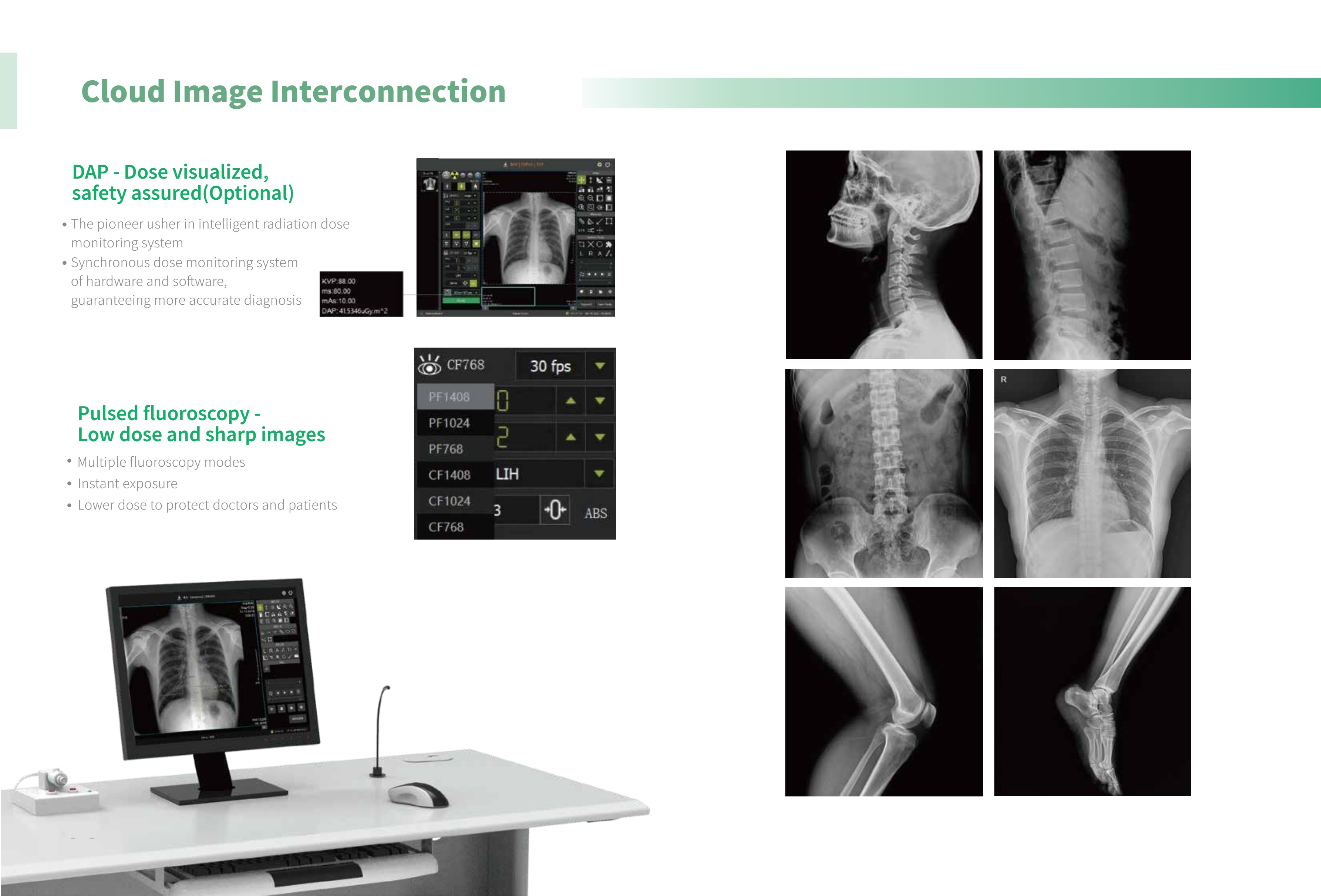 LXDRF-66 Dynamic FPD Radiography and Fluoroscopy System-4