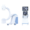 PLX112B1 High Frequency Mobile C-arm System