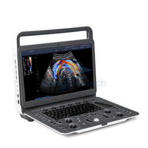 SonoScape E2 Color Doppler Ultrasound Machine