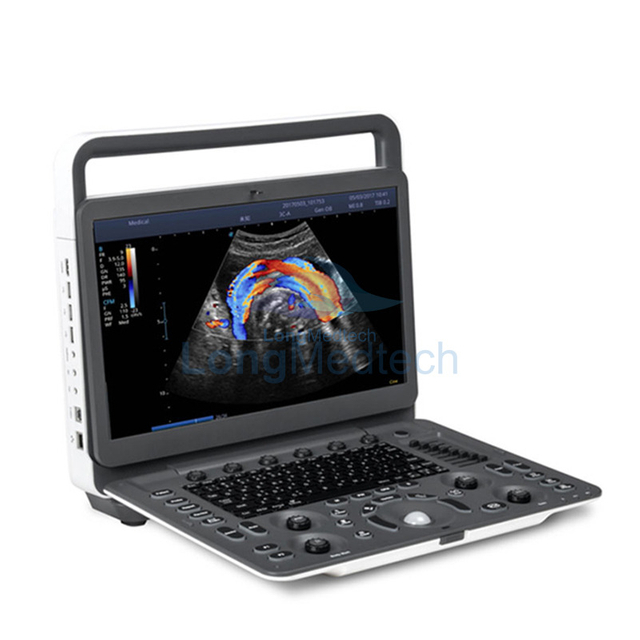 SonoScape E2 Color Doppler Ultrasound Machine
