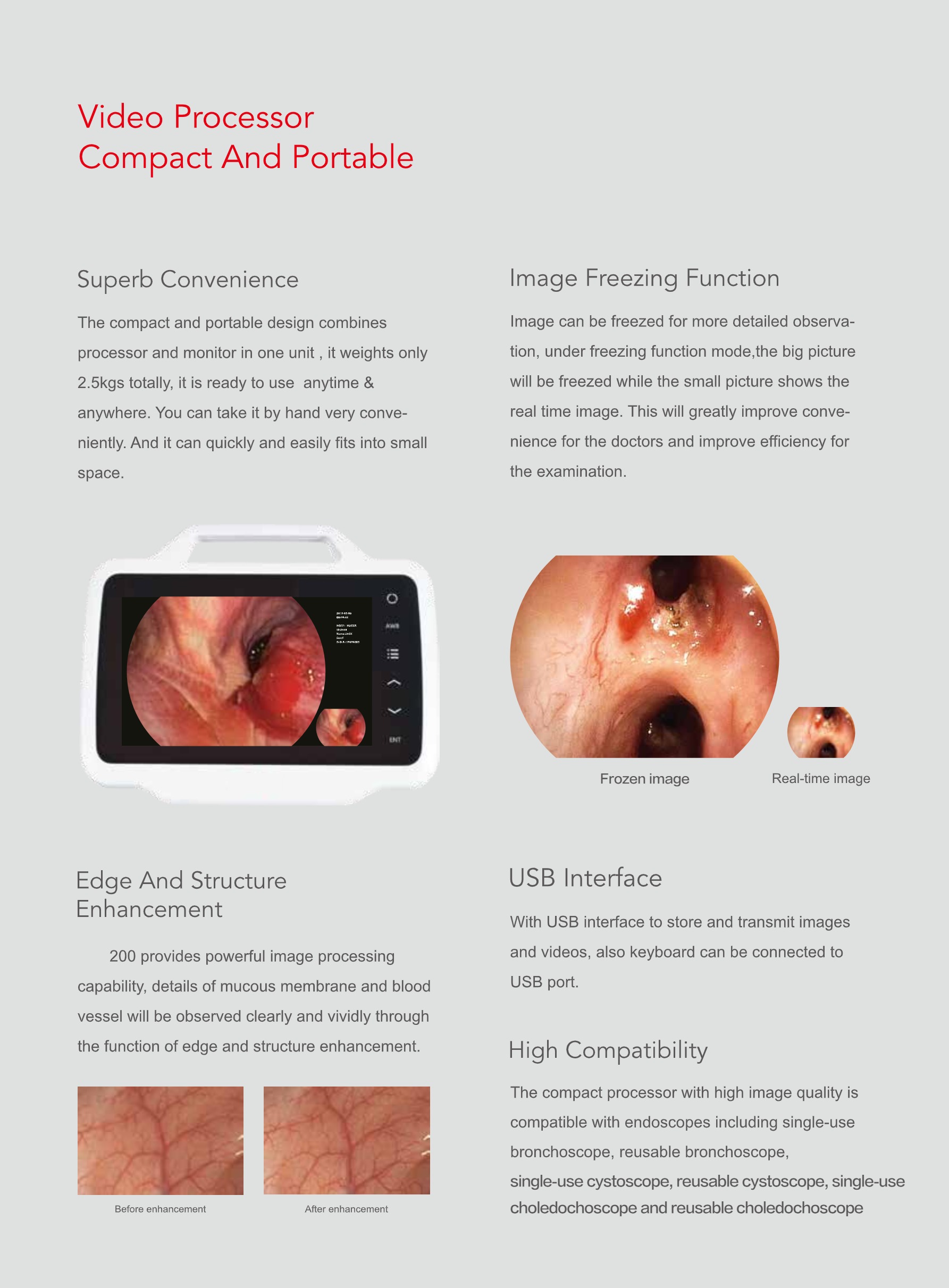 200 Series Endoscopy System-4