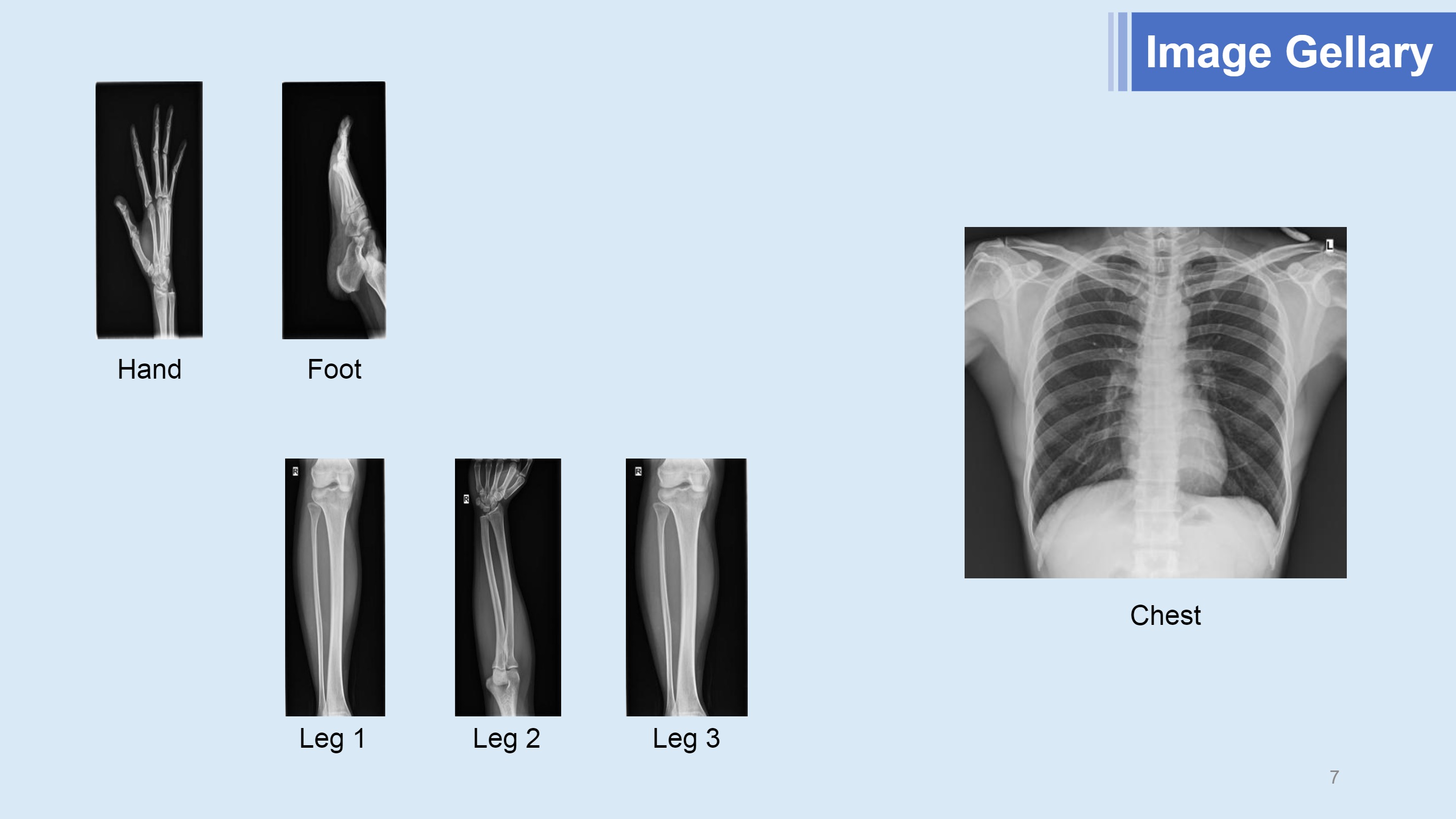 LXR120D Flat Panel Detector.-7