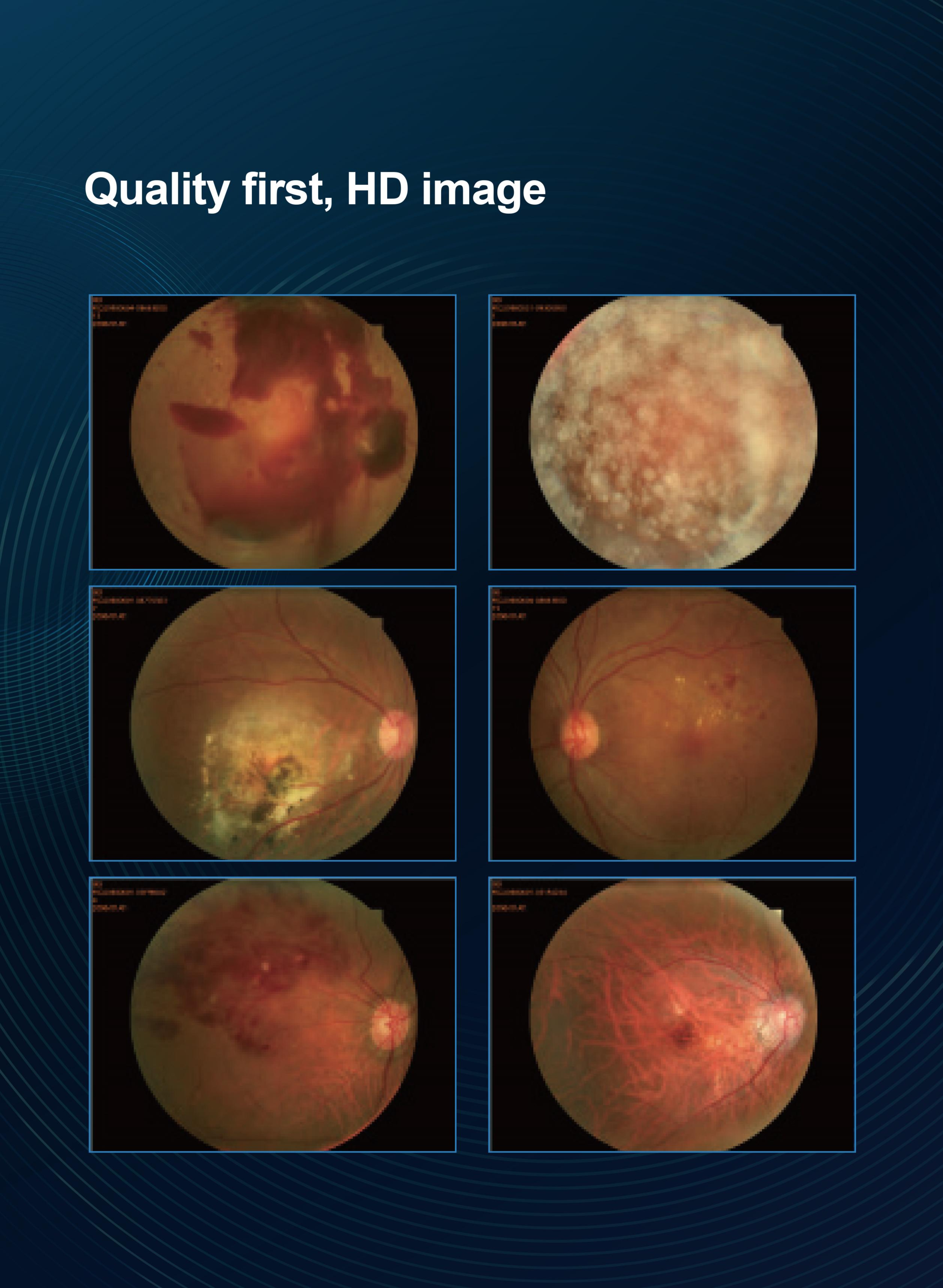 Cam&eacute;ra de fond automatique non mydriatique LM-3100-7