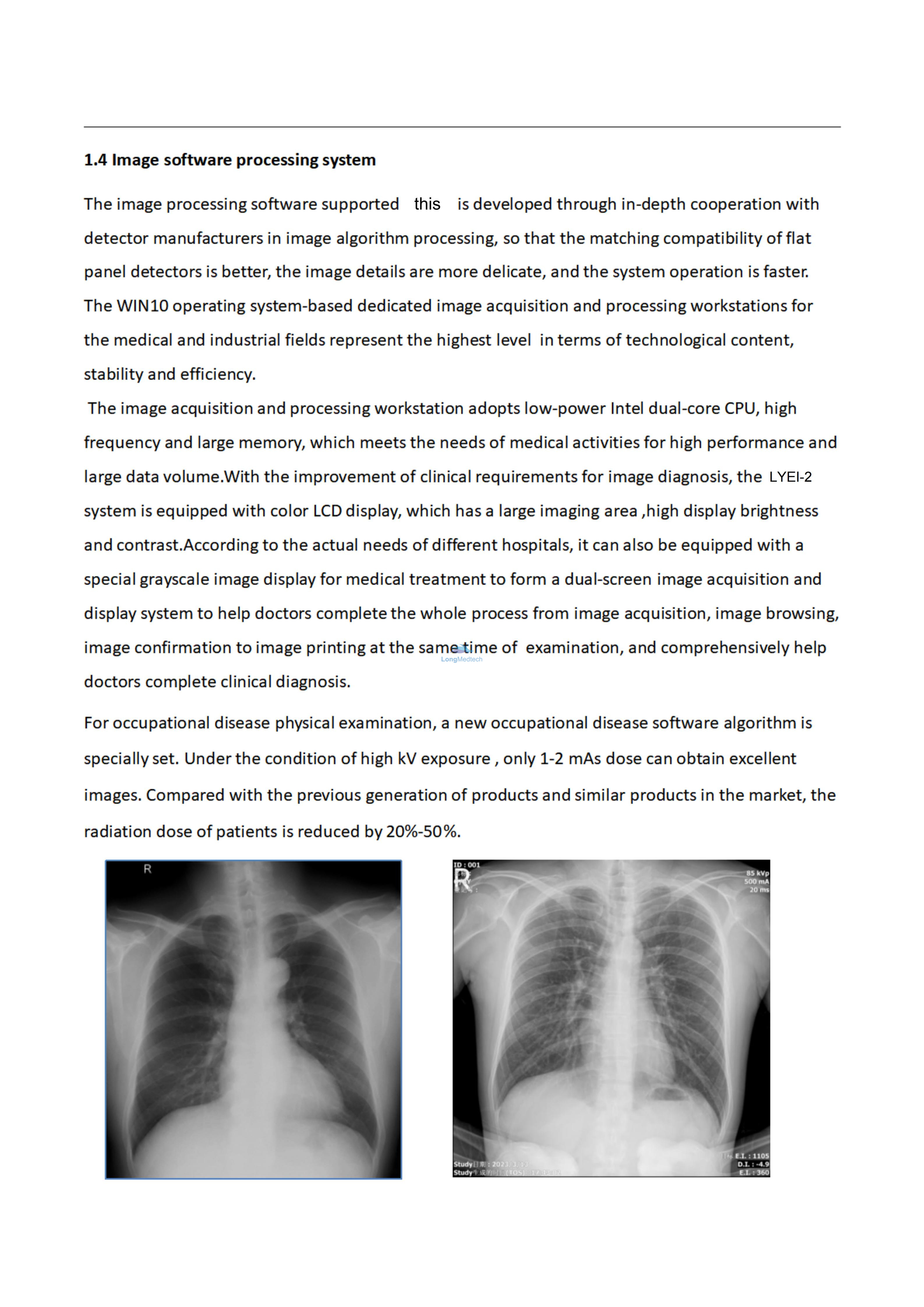 LYEI-3 Digital X-ray lmaging System_07