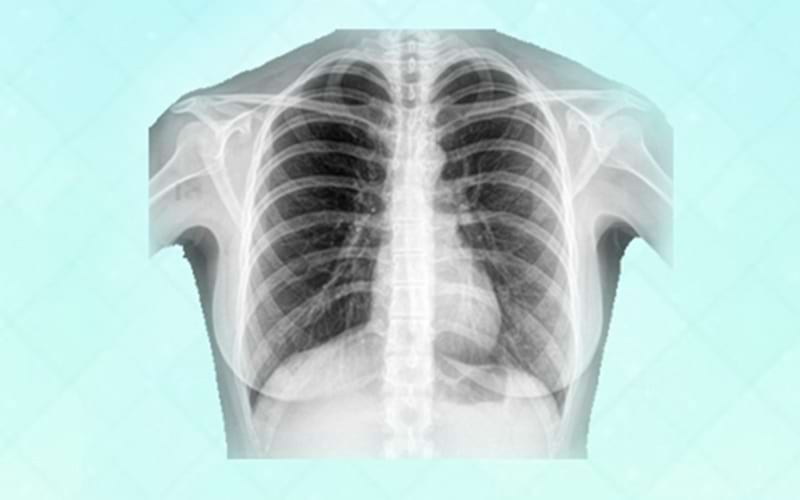 ما هو الفرق بين الأشعة السينية التناظرية والرقمية？