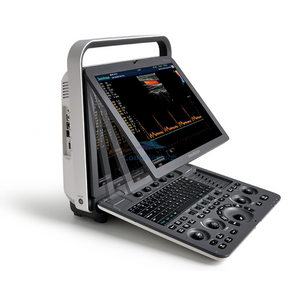 Sonoscape S8 Exp Portable Color Doppler