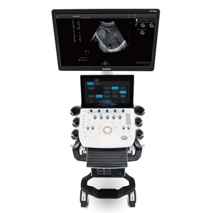 Sonoscape P25 Elite Trolley Color Doppler