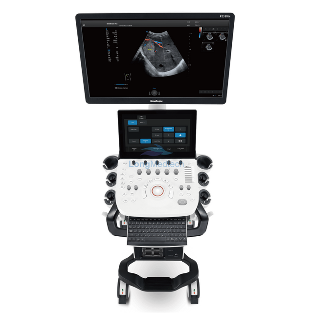 Sonoscape P25 Elite Trolley Color Doppler