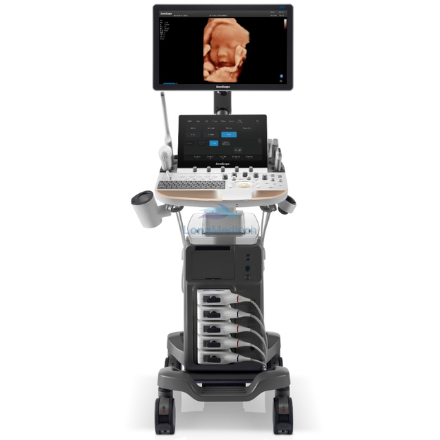 SonoScape P60 Intelligence Articulated