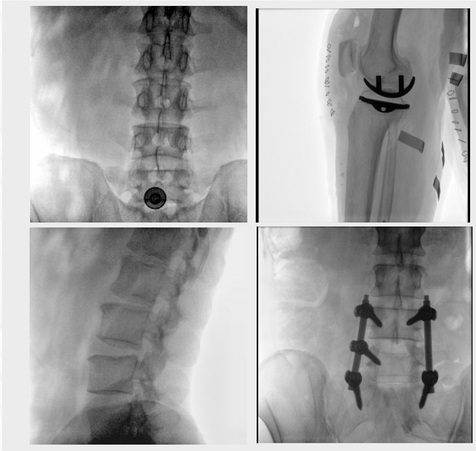 a5dc02ca6811a8df33f78b06e2a7804e