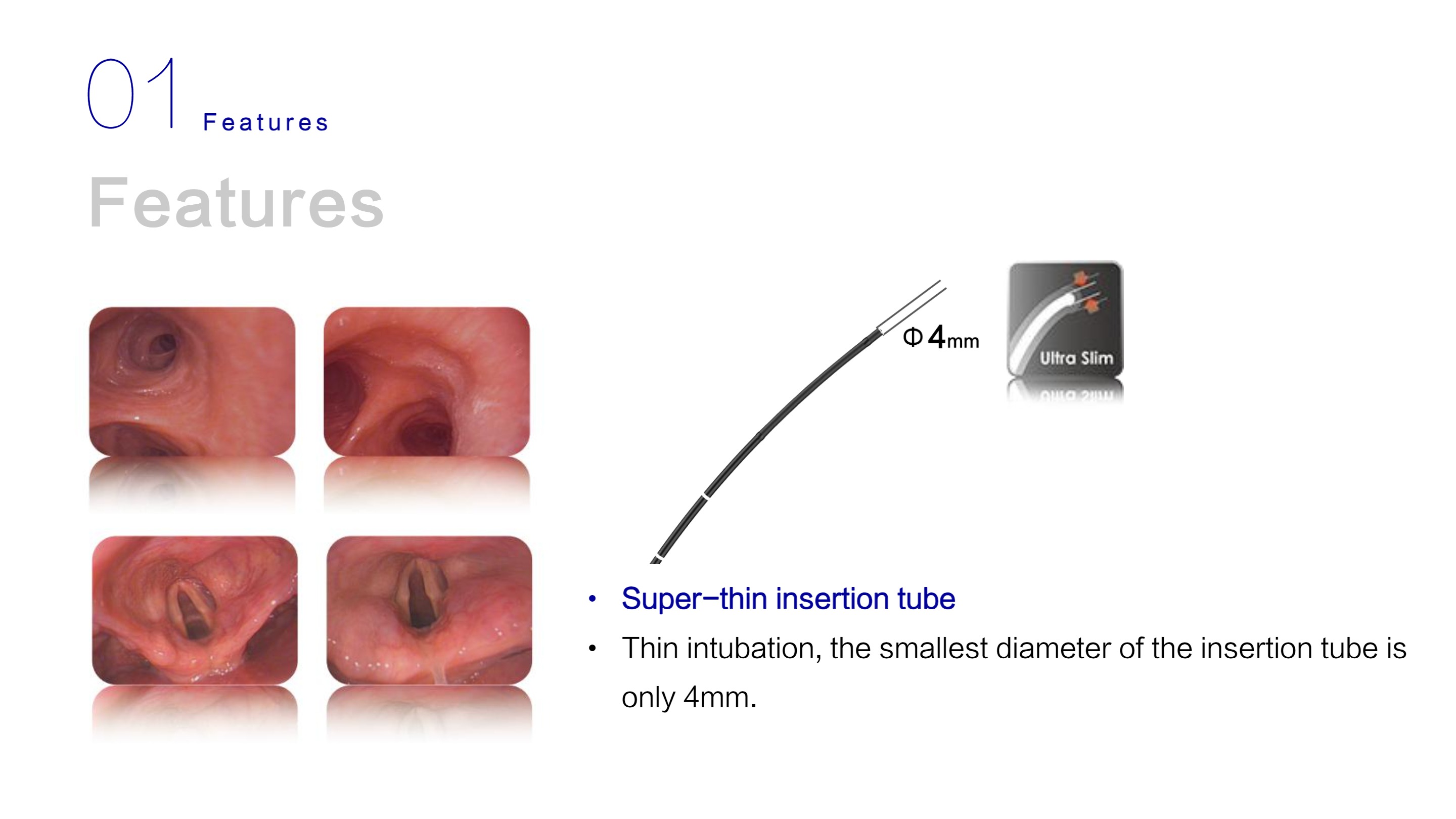 LHO-10 Mobile Endoscopy System-5