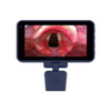 LKLR-8/LKLR-9/LKLR-10 Total Video Laryngoscope