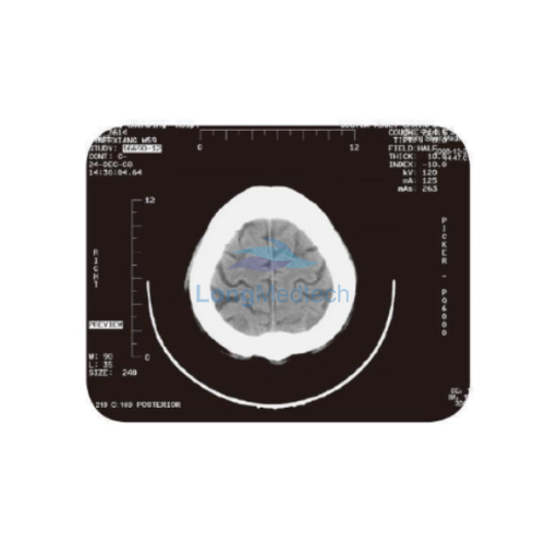 LFP-1300/LFP-1400 Thermal Medical Film